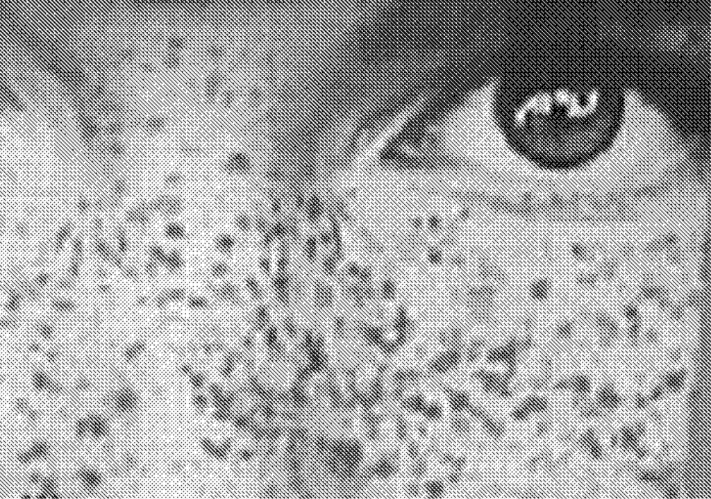 greyscale image of a close-up eye in a freckled face